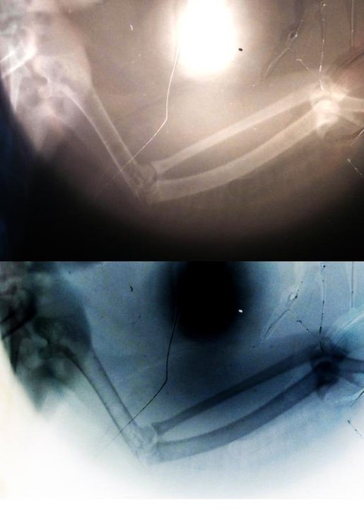 эпифизарный перелом плечевой локтевой лучевой голубь 001.jpg