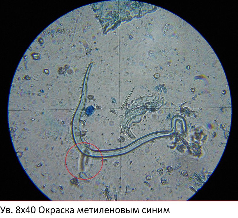 8х40_вероятный гельминт и инвазионное яйцо.jpg