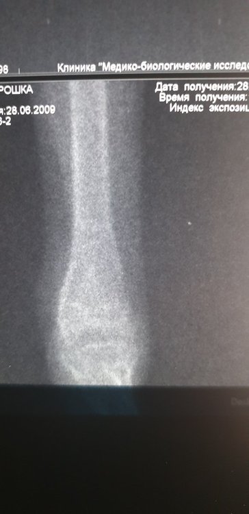 20200428_203033.jpg