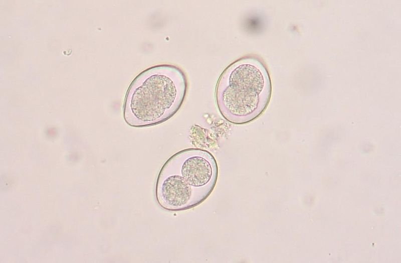 204334599_800px-Coccidia1.JPG.b7329a88bb9bed15d446b721fbfa8e9e.JPG