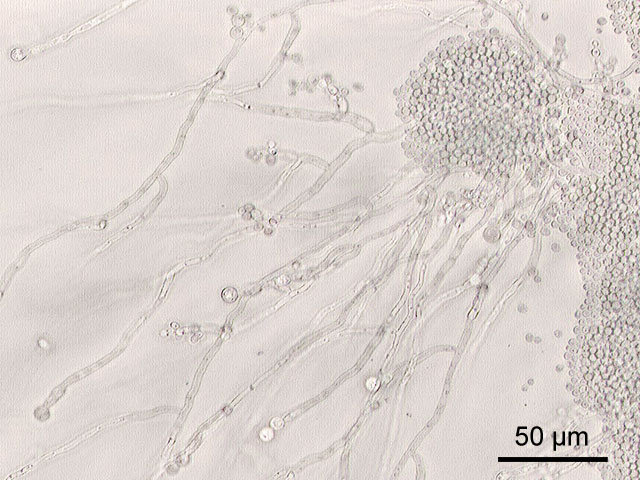 713383038_Candida_albicans1.jpg.1ec27bb9192002ee77d02c953ba631a0.jpg