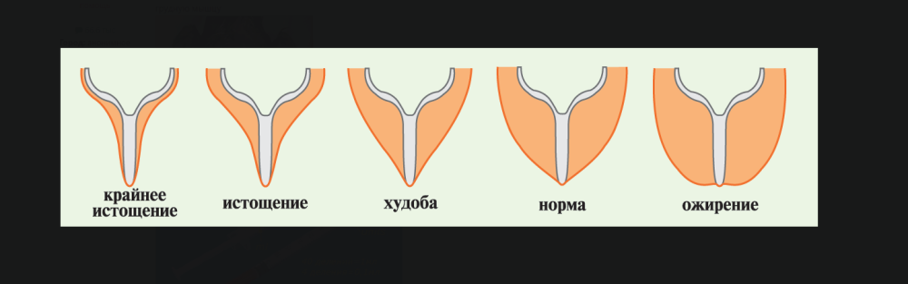 image.thumb.png.b918c3e7b4fe424b8323c679b27ea08f.png