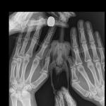 post-43673-1451521047_thumb.jpg