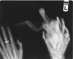 post-49179-1372510533_thumb.jpg