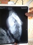 post-62479-1439430593_thumb.jpg