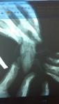 post-64802-1455520113_thumb.jpg