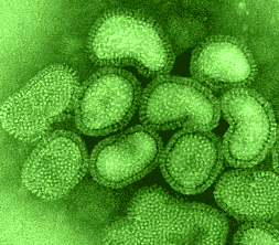 так выглядит вирус гриппа при увеличении, © Copyright Linda M Stannard, 1995. 